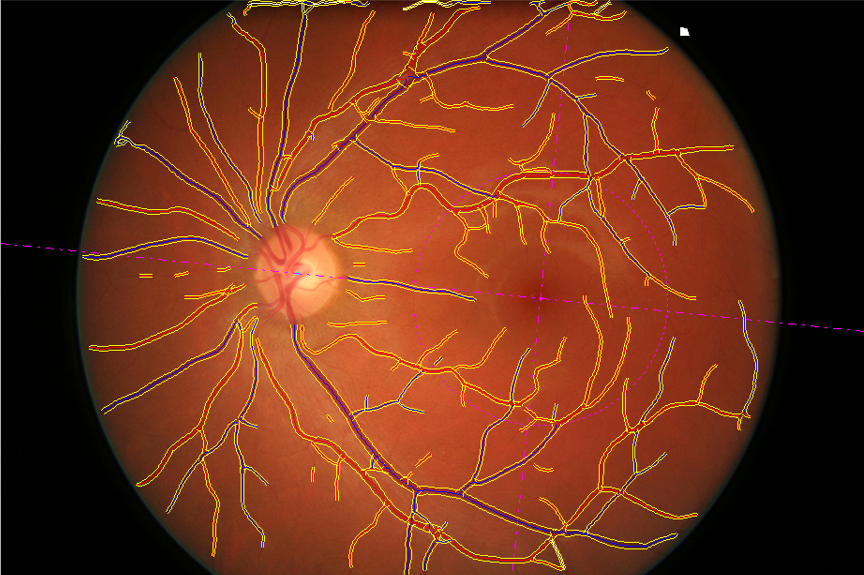 A retina image